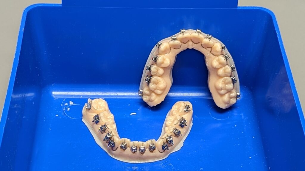 Full brackets on model