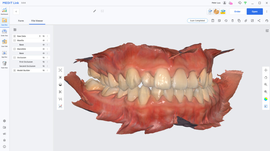 Completed scanned teeth