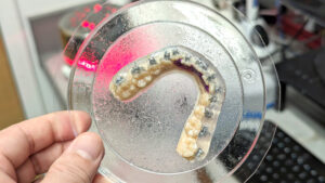 Model with dual trays - First Impression Orthodontics IDB, Fast comfortable Braces