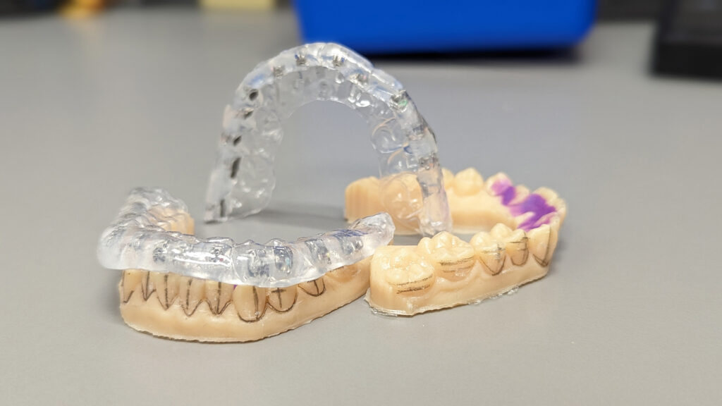 Final Indirect Bonding Tray