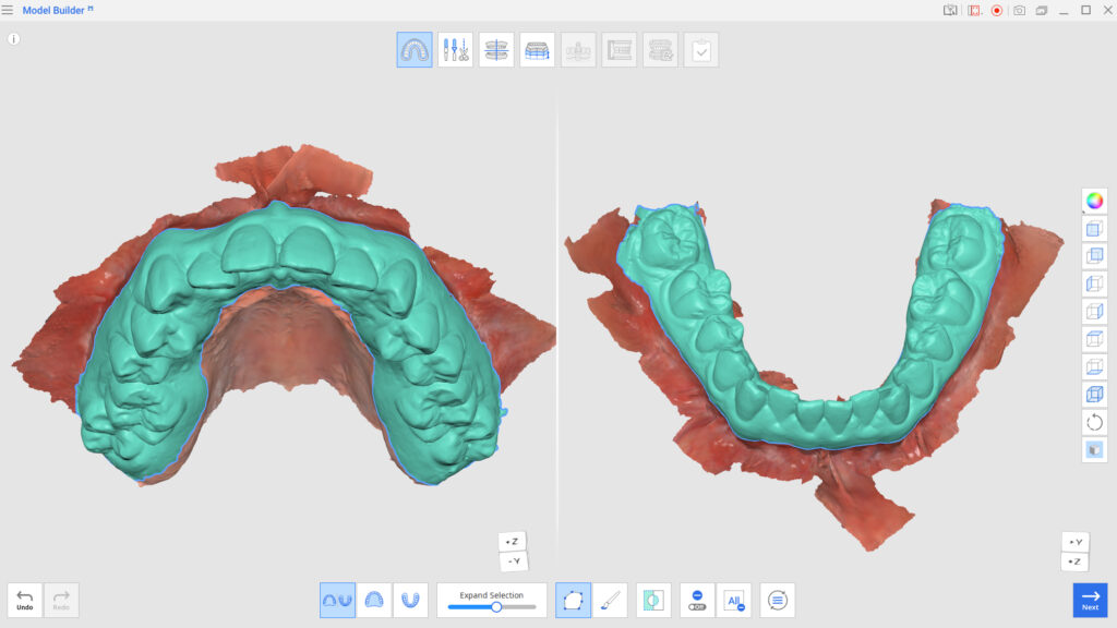 Digital model trimming