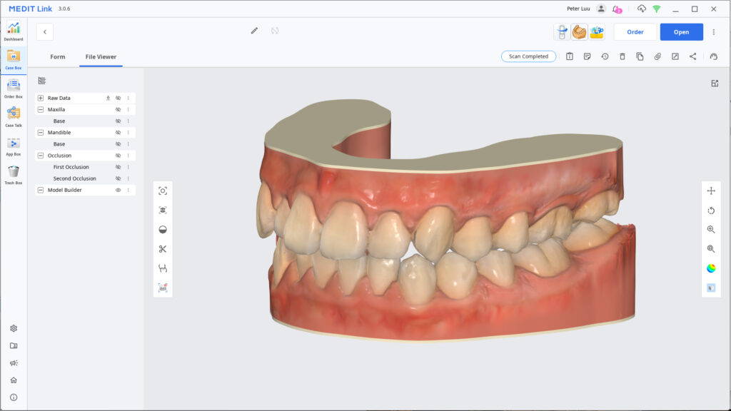 Trimmed Digital Model