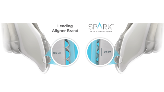 Spark Clear Aligners