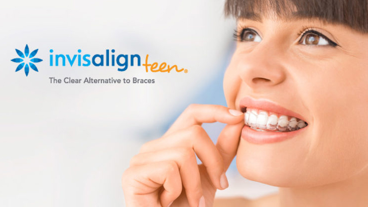 Invisalign Teen - First Impression Orthodontics
